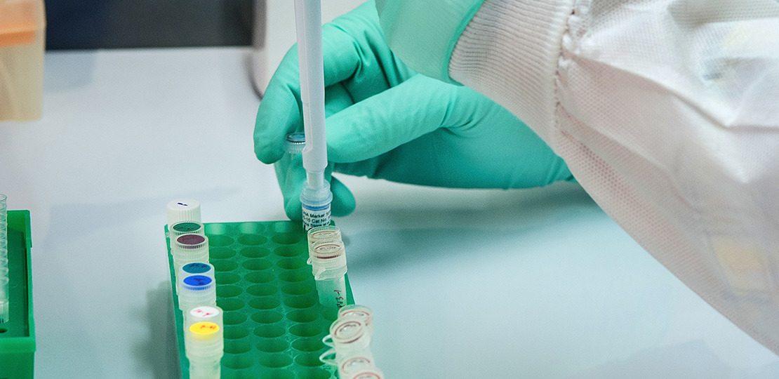 Medical samples being processed in a lab (photo)